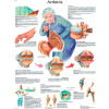 3B® Anatomical Chart - Arthritis, Paper