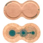 Iontophoresis Electrodes & Patches