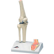 3B&#174; Anatomical Model - Mini Knee Joint with Cross Section of Bone on Base