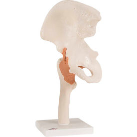 Fabrication Enterprises Inc 953619 3B® Anatomical Model - Functional Hip Joint image.