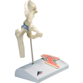 Fabrication Enterprises Inc 956176 3B® Anatomical Model - Mini Hip Joint with Cross Section of Bone on Base image.