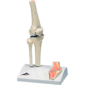 Fabrication Enterprises Inc 956541 3B® Anatomical Model - Mini Knee Joint with Cross Section of Bone on Base image.