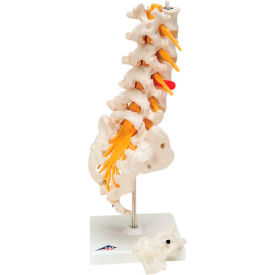 Fabrication Enterprises Inc 965672 3B® Anatomical Model - Lumbar Spinal Column with Dorso-Lateral Prolapsed Disc image.