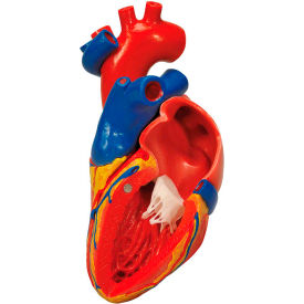 Fabrication Enterprises Inc 974804 3B® Anatomical Model - Heart with Bypass, 2-Part image.