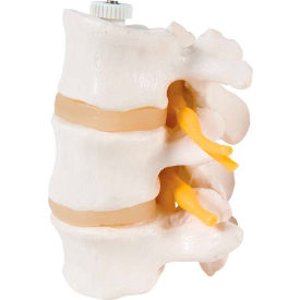 Fabrication Enterprises Inc 985031 3B® Anatomical Model - 3 Lumbar Vertebrae, Flexibly Mounted image.