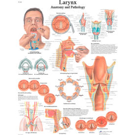 Fabrication Enterprises Inc 12-4612L 3B® Anatomical Chart - Larynx, Laminated image.