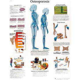 Fabrication Enterprises Inc 12-4615L 3B® Anatomical Chart - Osteoporosis, Laminated image.