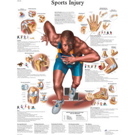 Fabrication Enterprises Inc 12-4623L 3B® Anatomical Chart - Sports Injuries, Laminated image.