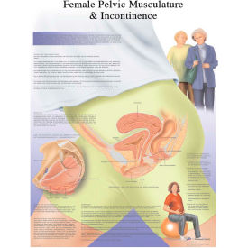 Fabrication Enterprises Inc 12-4632L 3B® Anatomical Chart - Female Urinary Incontinence Chart, Laminated image.