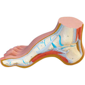 Fabrication Enterprises Inc 1060635 3B® Anatomical Model - Hollow Foot (Pes Cavus) image.