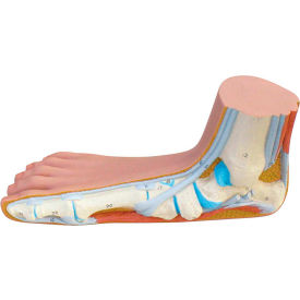 Fabrication Enterprises Inc 1061001 3B® Anatomical Model - Flat Foot (Pes Panus) image.