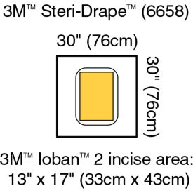 3M 6658 3M™ Steri-Drape Pouch with Ioban 2 Incise Film, 6658, 30" x 30", 5/Carton, 4/Case image.