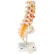 3B® Anatomical Model - Lumbar Spinal Column with Dorso-Lateral Prolapsed Disc