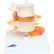 3B® Anatomical Model - Lumbar Spinal Column with Prolapsed Intervertebral Disc
