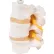 3B® Anatomical Model - 3 Lumbar Vertebrae, Flexibly Mounted