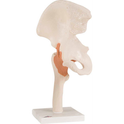 3B® Anatomical Model - Functional Hip Joint
