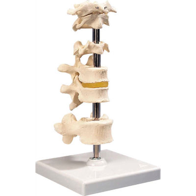 3B® Anatomical Model - 5 Mounted Vertebrae with Removable Stand