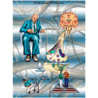 3B® Anatomical Chart - Parkinson's Disease, Laminated