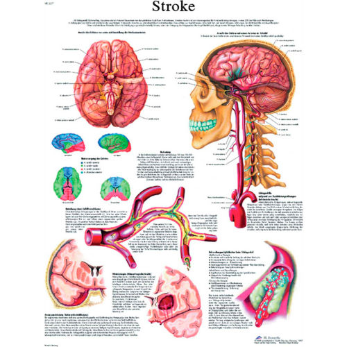 3B&#174; Anatomical Chart - Stroke Chart Paper